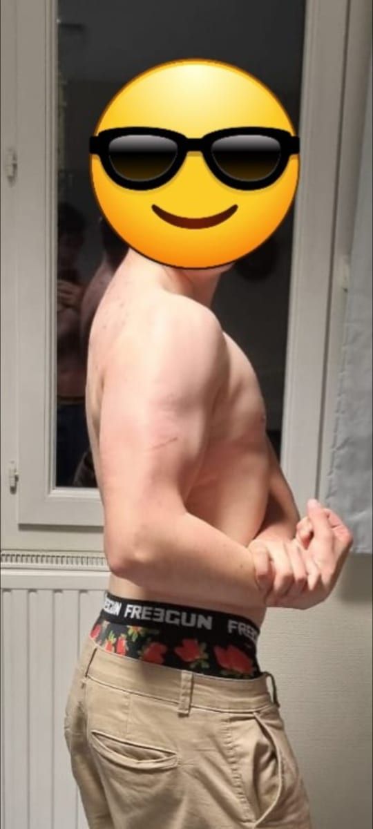 Perfil de Ernst